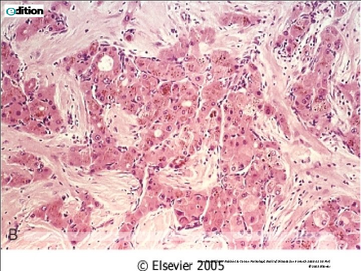 Downloaded from: Robbins & Cotran Pathologic Basis of Disease (on 9 March 2006 02: Downloaded from: Robbins & Cotran Pathologic Basis of Disease (on 9 March 2006 02: