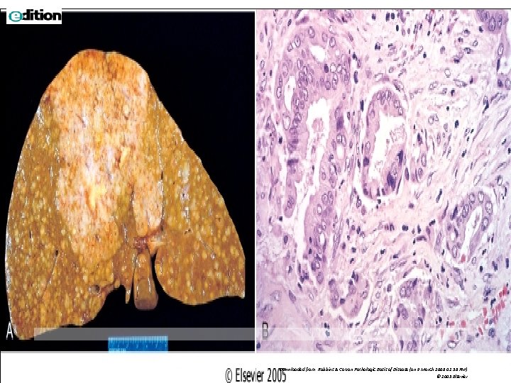 Downloaded from: Robbins & Cotran Pathologic Basis of Disease (on 9 March 2006 02: