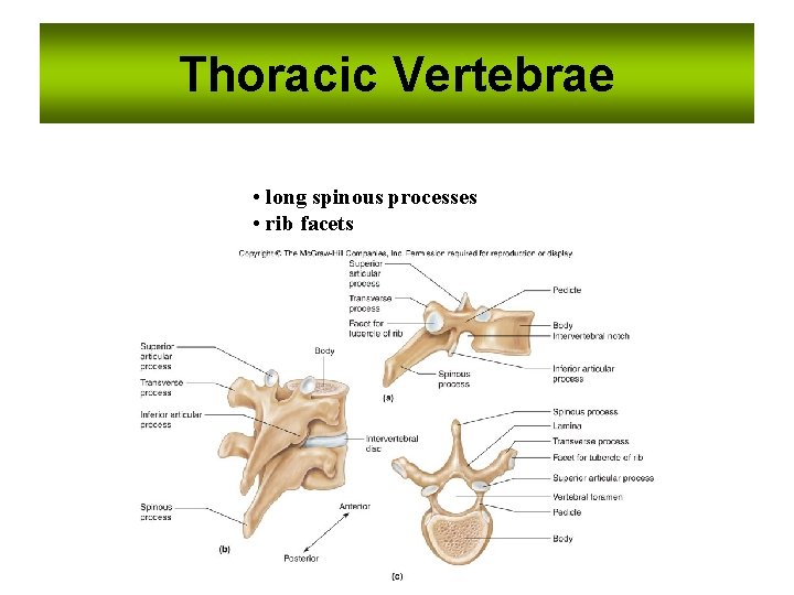 Thoracic Vertebrae • long spinous processes • rib facets Thoracic Vertebrae • long spinous processes • rib facets