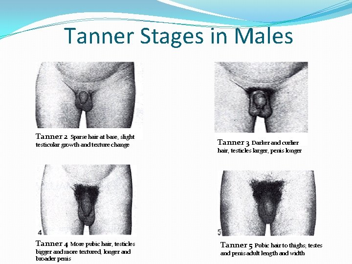 Tanner Stages in Males Tanner 2 Sparse hair at base, slight testicular growth and Tanner Stages in Males Tanner 2 Sparse hair at base, slight testicular growth and