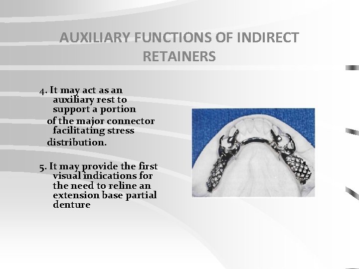 AUXILIARY FUNCTIONS OF INDIRECT RETAINERS 4. It may act as an auxiliary rest to