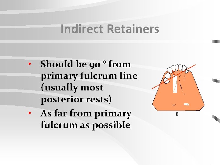 Indirect Retainers • Should be 90 ° from primary fulcrum line (usually most posterior