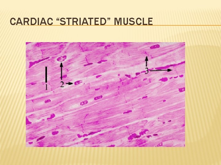 CARDIAC “STRIATED” MUSCLE 