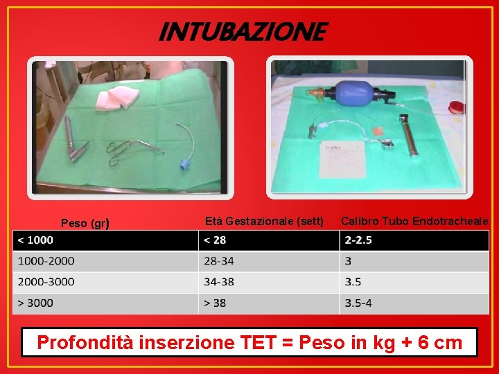 INTUBAZIONE Peso (gr) Età Gestazionale (sett) Calibro Tubo Endotracheale Profondità inserzione TET = Peso