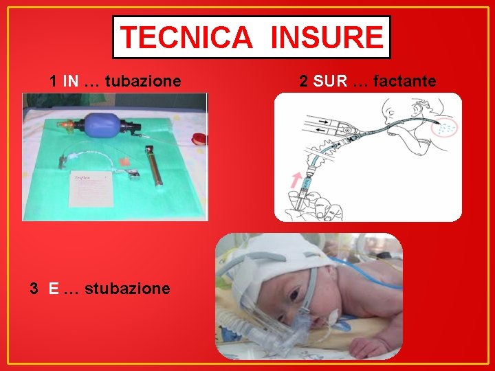 TECNICA INSURE 1 IN … tubazione 3 E … stubazione 2 SUR … factante