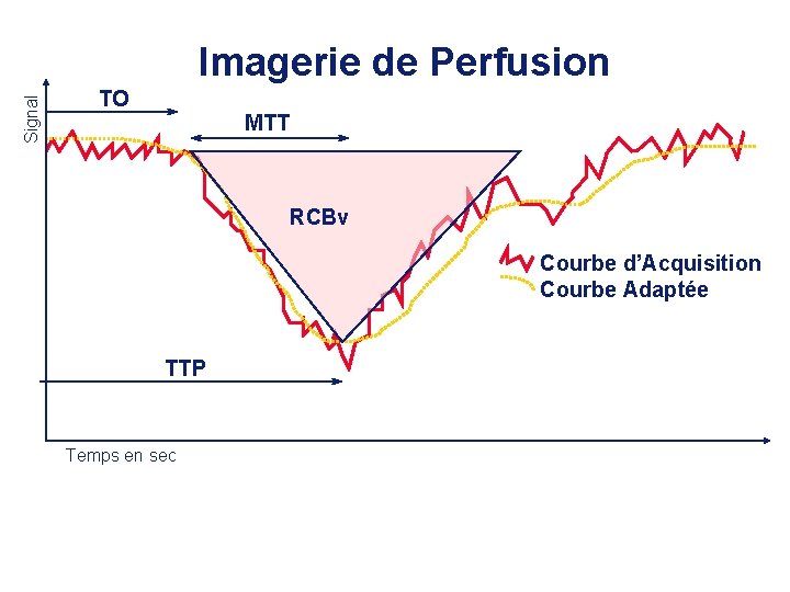 Signal Imagerie de Perfusion TO MTT RCBv Courbe d’Acquisition Courbe Adaptée TTP Temps en