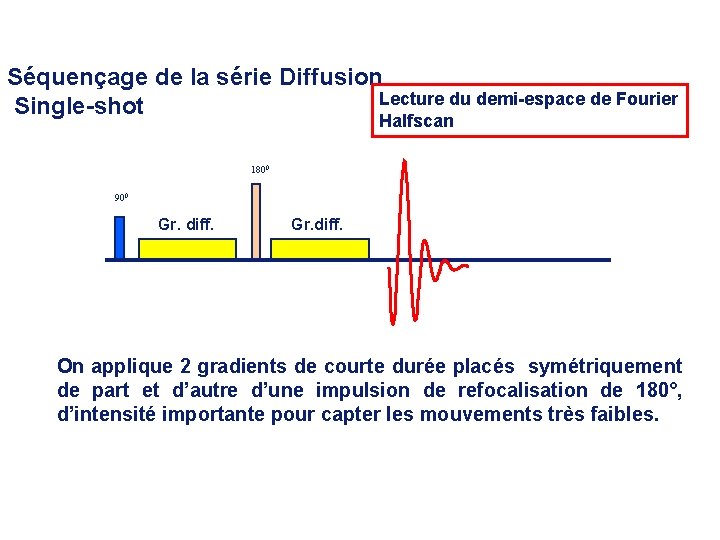 Séquençage de la série Diffusion Lecture du demi-espace de Fourier Single-shot Halfscan 1800 900