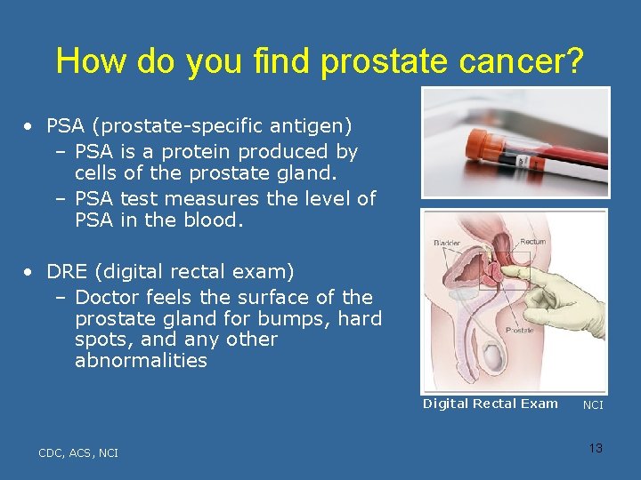 How do you find prostate cancer? • PSA (prostate-specific antigen) – PSA is a