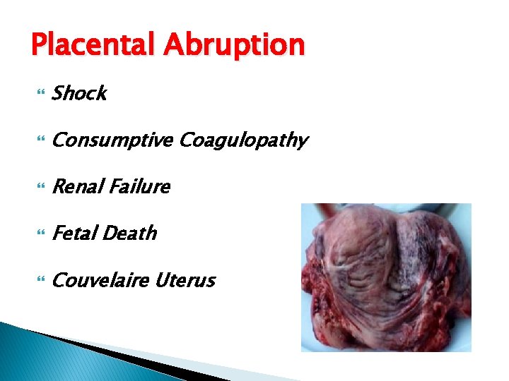 Placental Abruption Shock Consumptive Coagulopathy Renal Failure Fetal Death Couvelaire Uterus 