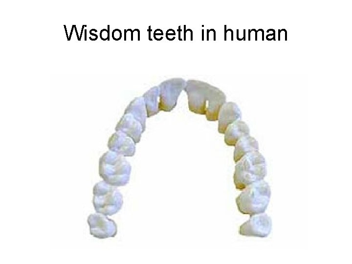 Wisdom teeth in human 