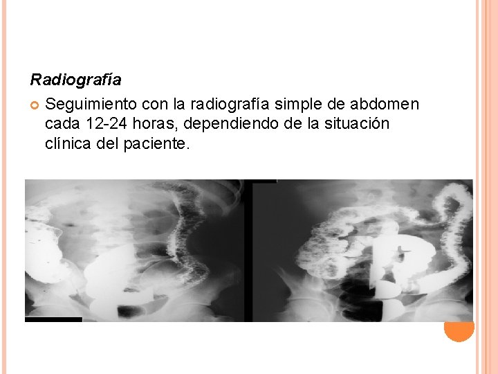 Radiografía Seguimiento con la radiografía simple de abdomen cada 12 -24 horas, dependiendo de