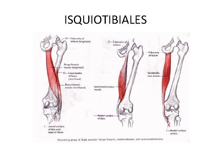 ISQUIOTIBIALES 