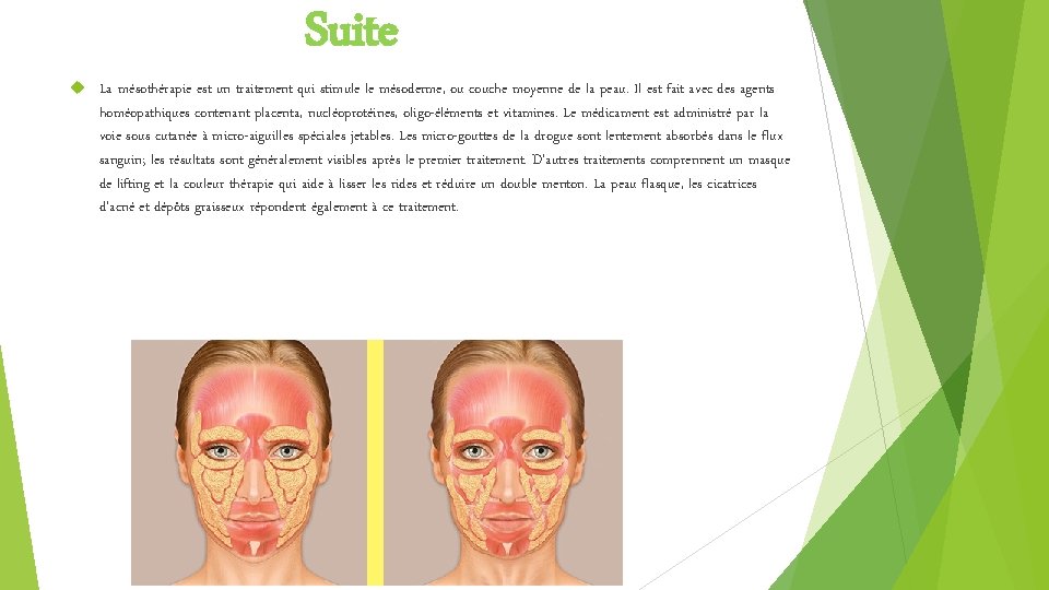  Suite La mésothérapie est un traitement qui stimule le mésoderme, ou couche moyenne
