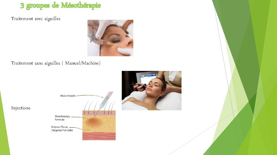 3 groupes de Mésothérapie Traitement avec aiguilles Traitement sans aiguilles ( Manuel/Machine) Injections 3 groupes de Mésothérapie Traitement avec aiguilles Traitement sans aiguilles ( Manuel/Machine) Injections