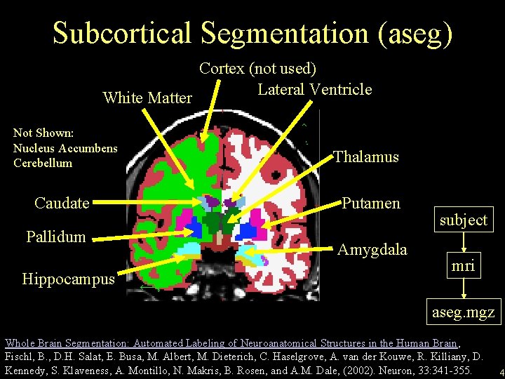 Subcortical Segmentation (aseg) Cortex (not used) Lateral Ventricle White Matter Not Shown: Nucleus Accumbens