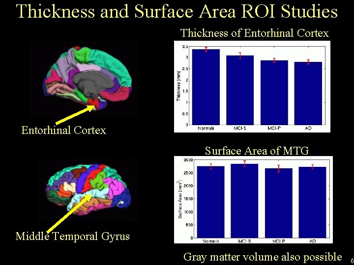 Thickness and Surface Area ROI Studies Thickness of Entorhinal Cortex Surface Area of MTG