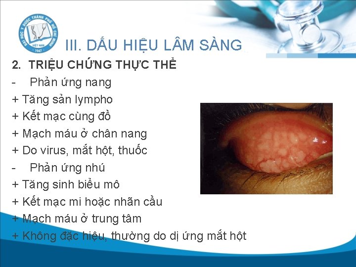 III. DẤU HIỆU L M SÀNG 2. TRIỆU CHỨNG THỰC THỂ - Phản ứng