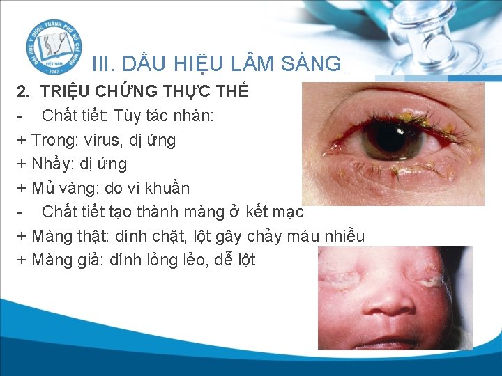 III. DẤU HIỆU L M SÀNG 2. TRIỆU CHỨNG THỰC THỂ - Chất tiết: