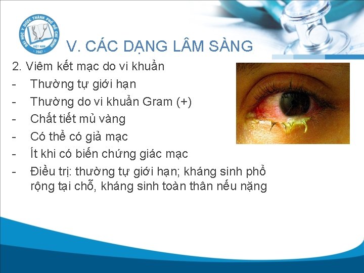 V. CÁC DẠNG L M SÀNG 2. Viêm kết mạc do vi khuẩn -