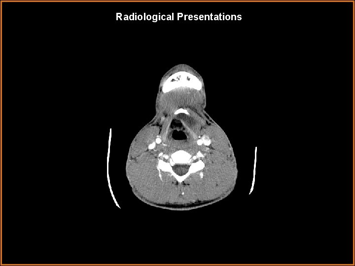 Radiological Presentations 