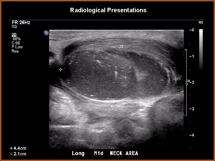 Radiological Presentations 