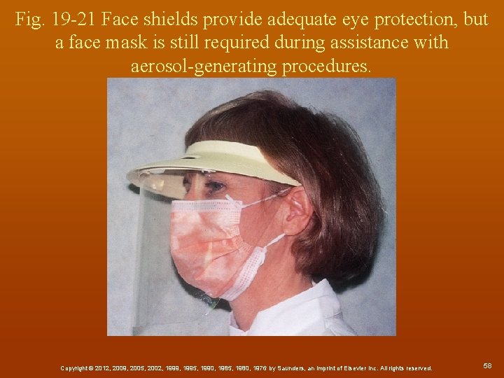 Fig. 19 -21 Face shields provide adequate eye protection, but a face mask is