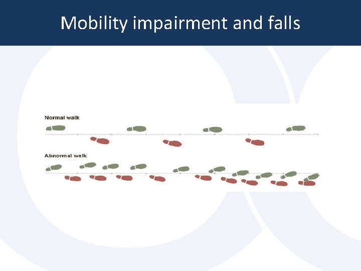Mobility impairment and falls Mobility impairment and falls