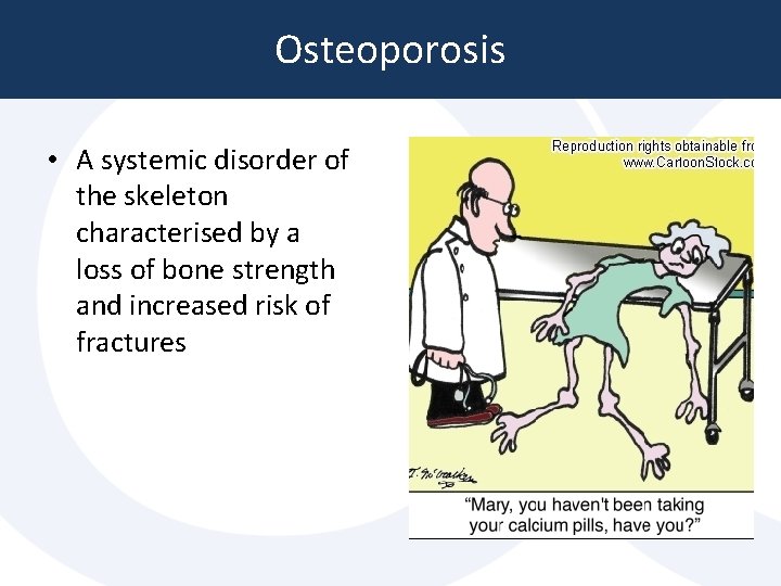 Osteoporosis • A systemic disorder of the skeleton characterised by a loss of bone Osteoporosis • A systemic disorder of the skeleton characterised by a loss of bone