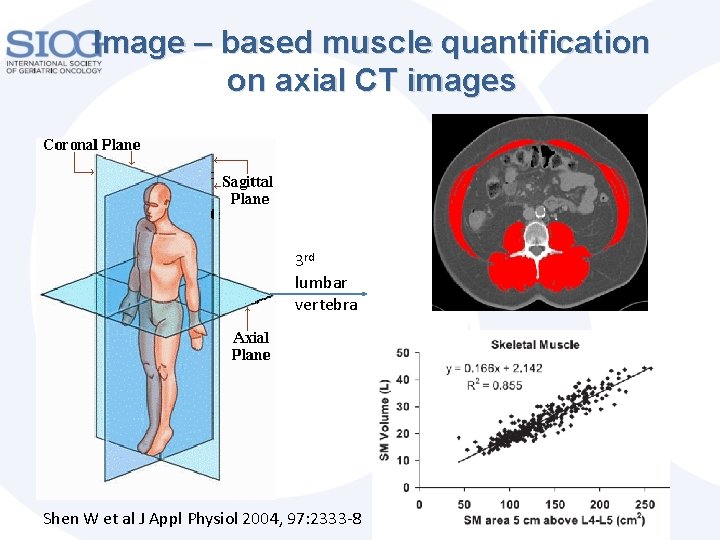 Image – based muscle quantification on axial CT images 3 rd lumbar vertebra Shen Image – based muscle quantification on axial CT images 3 rd lumbar vertebra Shen