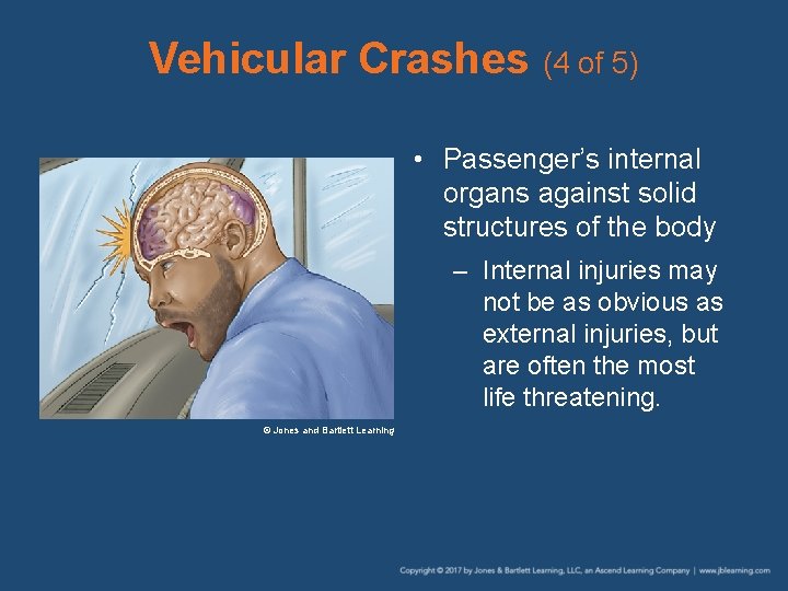 Vehicular Crashes (4 of 5) • Passenger’s internal organs against solid structures of the