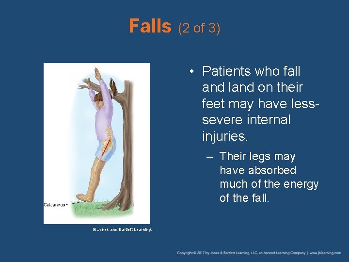 Falls (2 of 3) • Patients who fall and land on their feet may