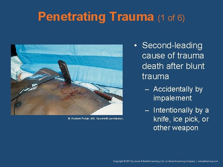 Penetrating Trauma (1 of 6) • Second-leading cause of trauma death after blunt trauma