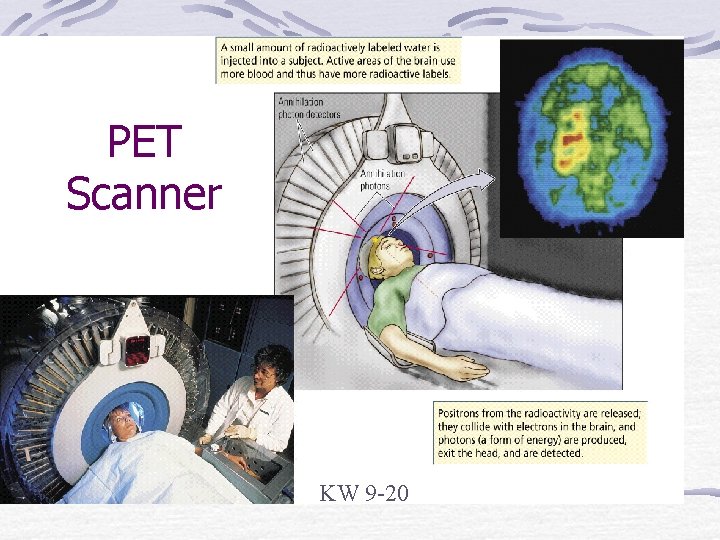 PET Scanner KW 9 -20 