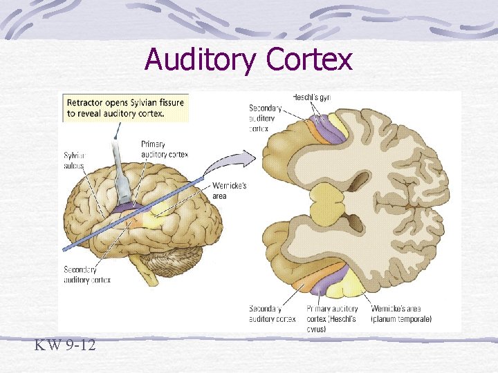 Auditory Cortex KW 9 -12 