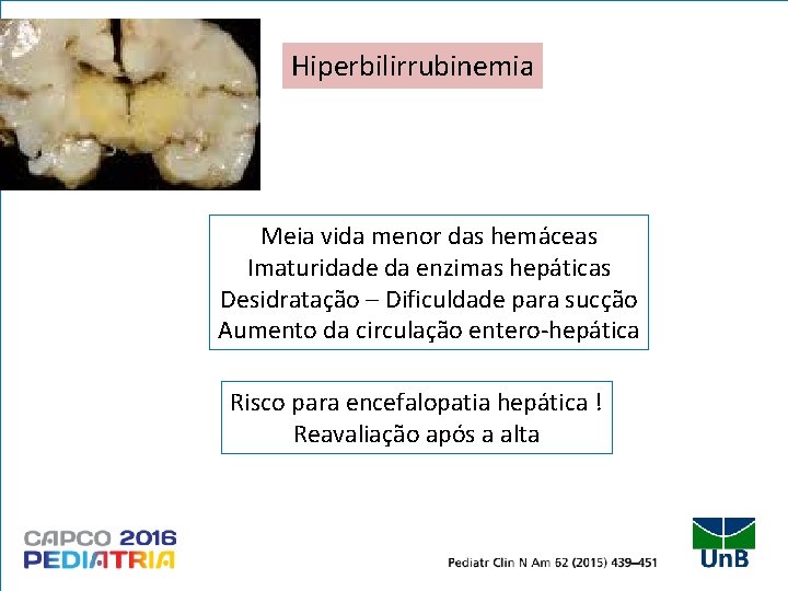Hiperbilirrubinemia Meia vida menor das hemáceas Imaturidade da enzimas hepáticas Desidratação – Dificuldade para