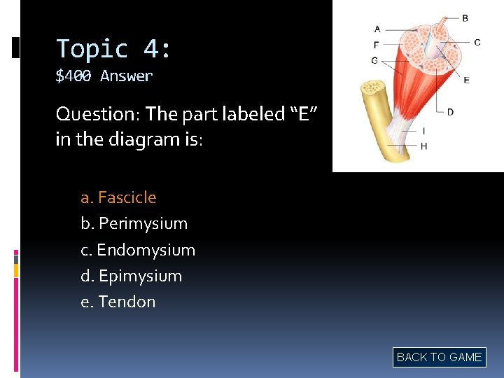 Topic 4: $400 Answer Question: The part labeled “E” in the diagram is: a.