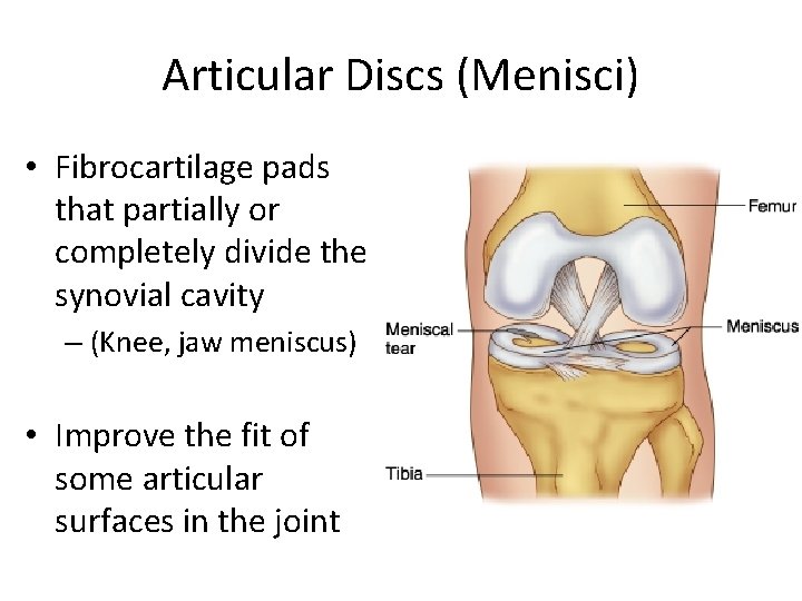Articular Discs (Menisci) • Fibrocartilage pads that partially or completely divide the synovial cavity