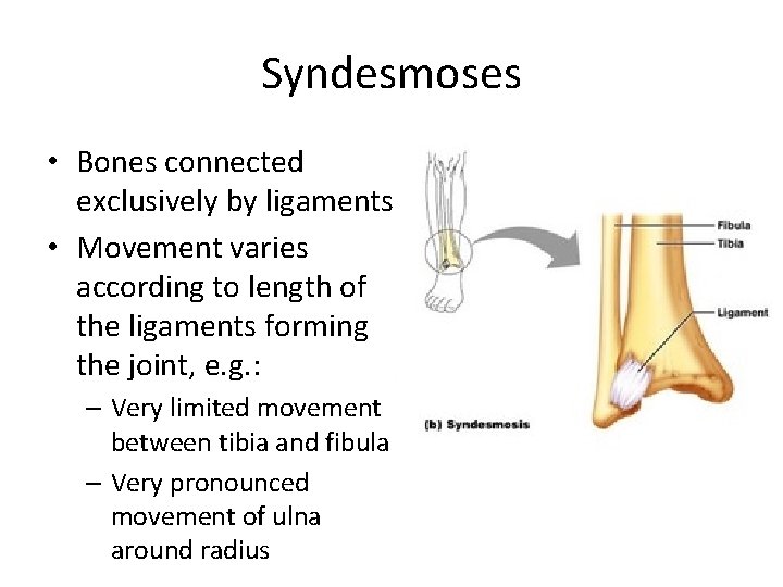 Syndesmoses • Bones connected exclusively by ligaments • Movement varies according to length of