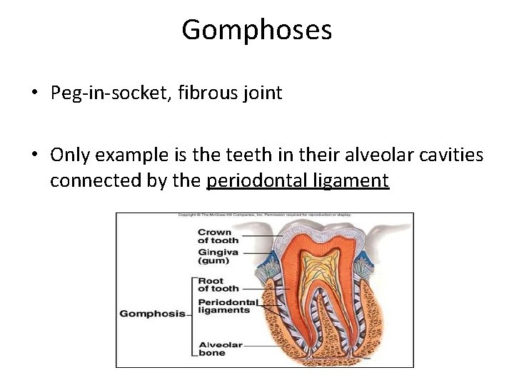 Gomphoses • Peg-in-socket, fibrous joint • Only example is the teeth in their alveolar