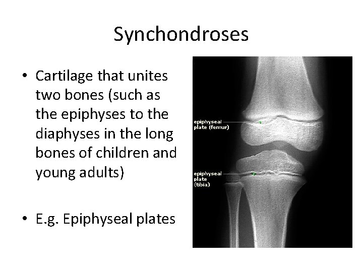 Synchondroses • Cartilage that unites two bones (such as the epiphyses to the diaphyses