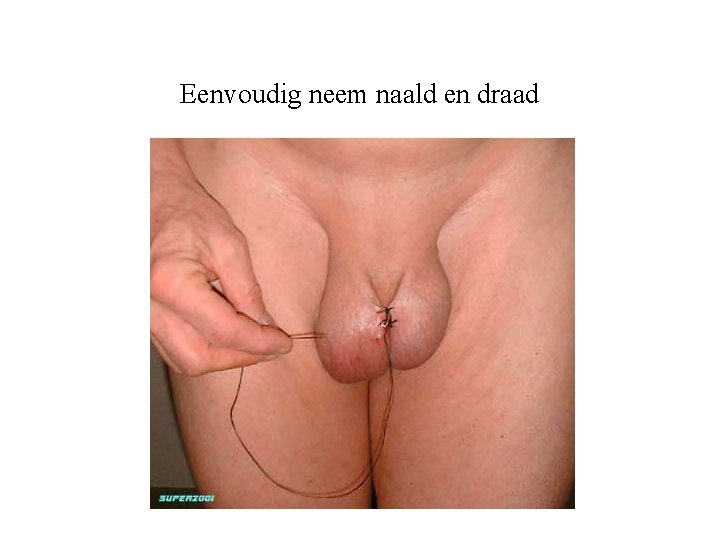 Eenvoudig neem naald en draad 