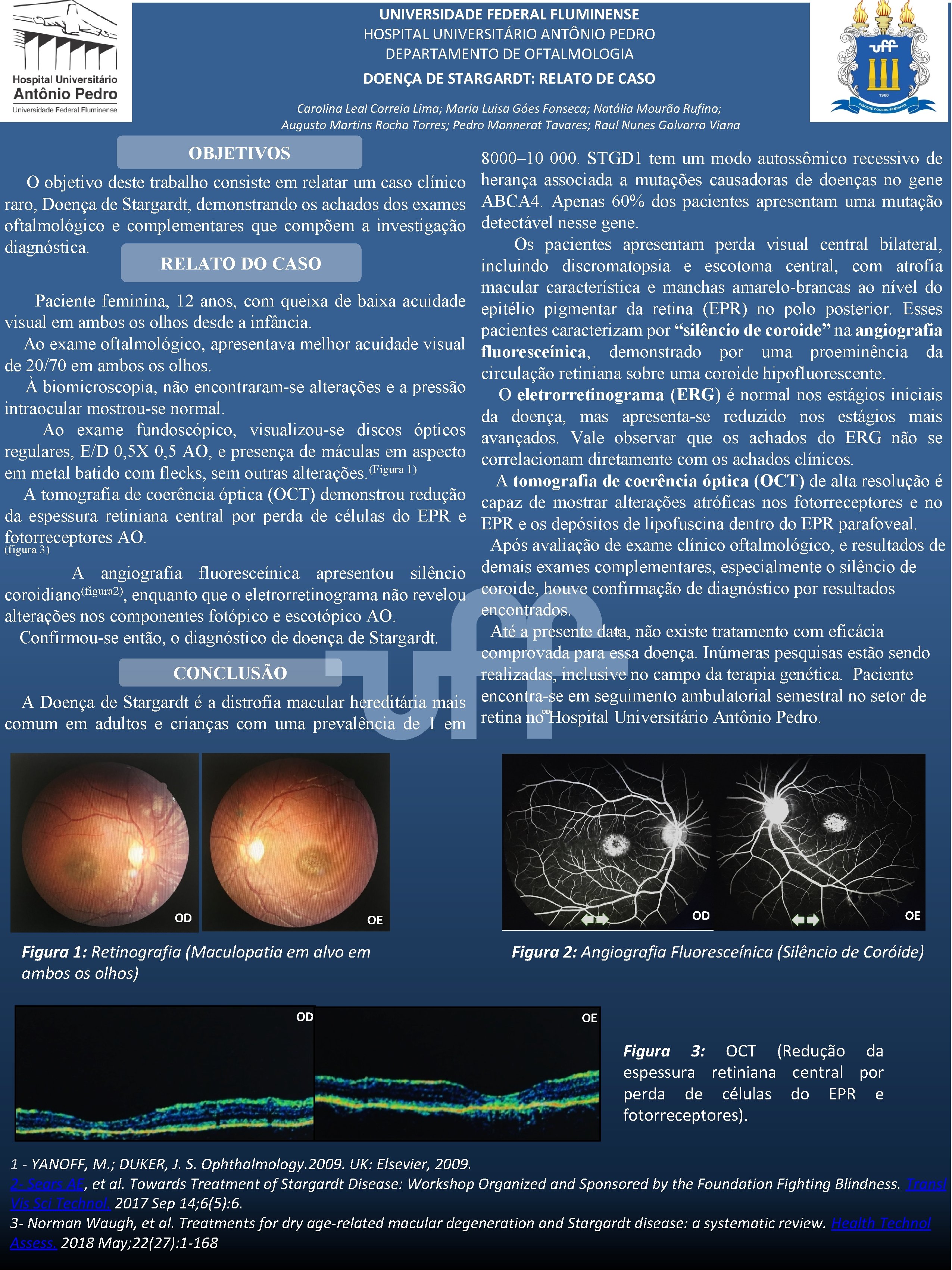UNIVERSIDADE FEDERAL FLUMINENSE HOSPITAL UNIVERSITÁRIO ANTÔNIO PEDRO DEPARTAMENTO DE OFTALMOLOGIA DOENÇA DE STARGARDT: RELATO