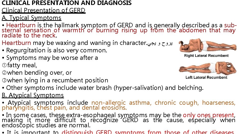 CLINICAL PRESENTATION AND DIAGNOSIS Clinical Presentation of GERD A. Typical Symptoms • Heartburn is