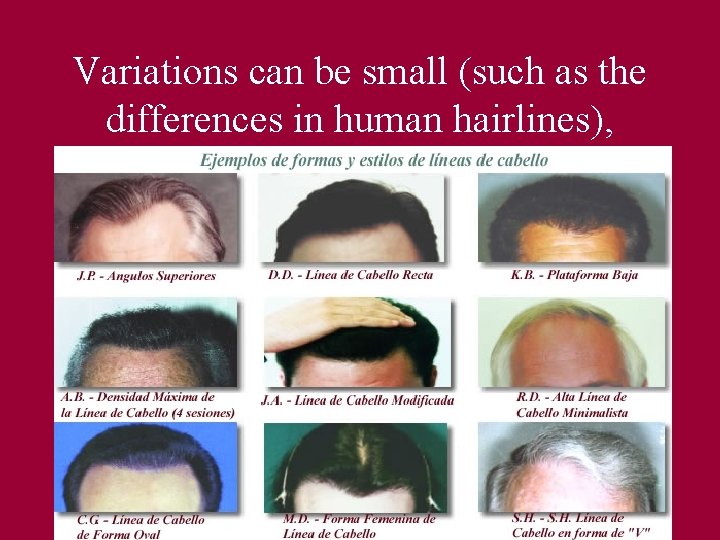 Variations can be small (such as the differences in human hairlines), Variations can be small (such as the differences in human hairlines),