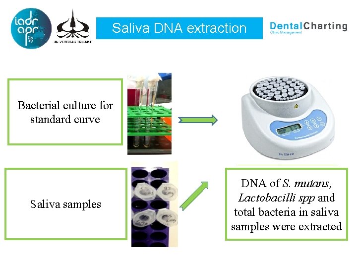 Saliva DNA extraction Bacterial culture for standard curve Saliva samples DNA of S. mutans,