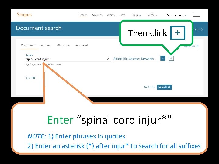 Your name Then click + Enter “spinal cord injur*” NOTE: 1) Enter phrases in
