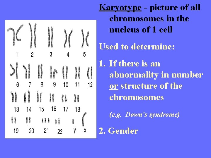 Karyotype - picture of all chromosomes in the nucleus of 1 cell Used to