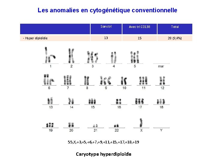 Les anomalies en cytogénétique conventionnelle - Hyper diploïdie Sans tri Avec tri CD 138