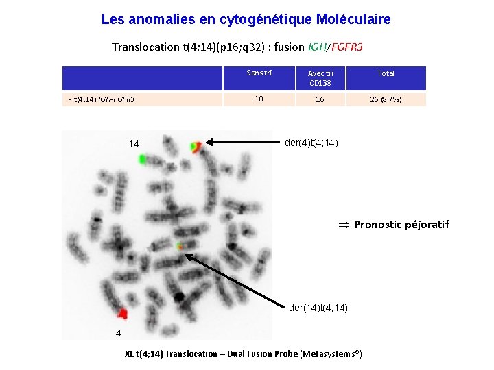 Les anomalies en cytogénétique Moléculaire Translocation t(4; 14)(p 16; q 32) : fusion IGH/FGFR
