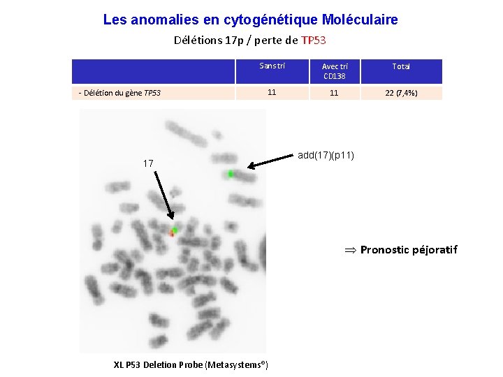 Les anomalies en cytogénétique Moléculaire Délétions 17 p / perte de TP 53 -